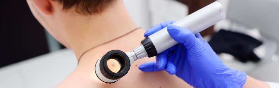 Moles Removal Fort Lauderdale