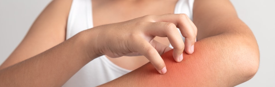 Dermatitis Treatment Fort Lauderdale