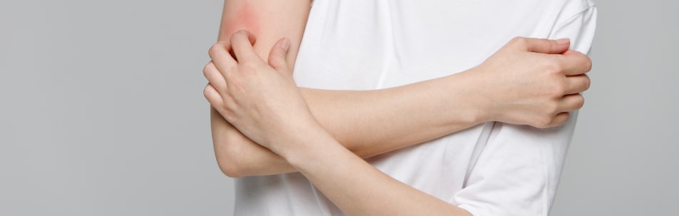 Psoriasis Treatment Fort Lauderdale