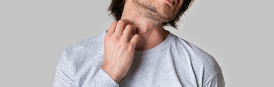 Rashes & Rash Treatment Fort Lauderdale