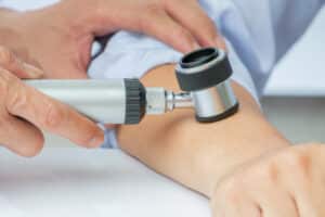Dermatologist uses dermatoscope to examine a patient’s arm during regular skin check.